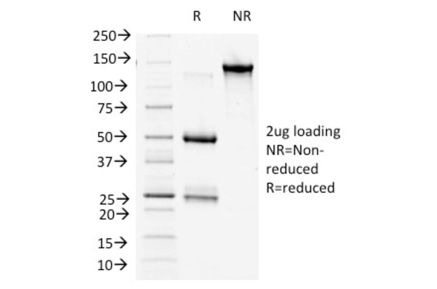 SDS-PAGE - Anti-beta Catenin Antibody [9F2] (A248296) - Antibodies.com