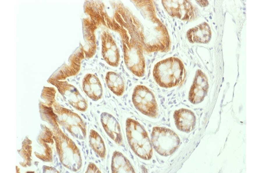Immunohistochemistry - Anti-beta Catenin Antibody [CTNNB1/1507] (A248298) - Antibodies.com