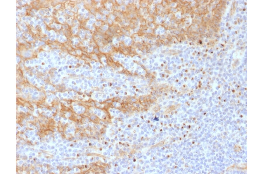 Immunohistochemistry - Anti-beta Catenin Antibody [CTNNB1/1508] (A248299) - Antibodies.com