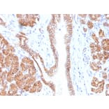 Immunohistochemistry - Anti-beta Catenin Antibody [CTNNB1/1508] (A248298) - Antibodies.com