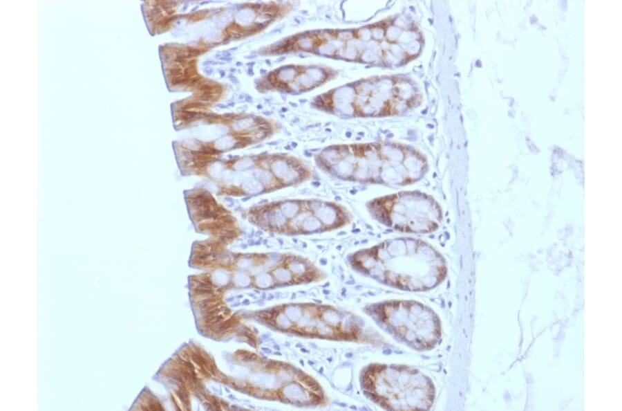 Immunohistochemistry - Anti-beta Catenin Antibody [CTNNB1/1508] (A248299) - Antibodies.com