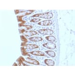 Immunohistochemistry - Anti-beta Catenin Antibody [CTNNB1/1508] (A248299) - Antibodies.com