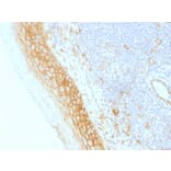 Immunohistochemistry - Anti-beta Catenin Antibody [CTNNB1/1509] (A248300) - Antibodies.com