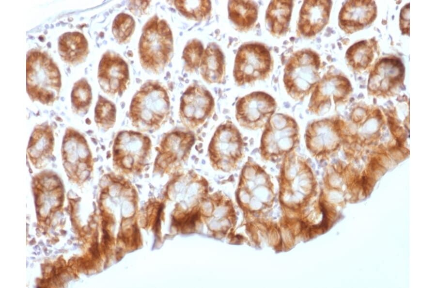 Immunohistochemistry - Anti-beta Catenin Antibody [CTNNB1/1509] (A248300) - Antibodies.com