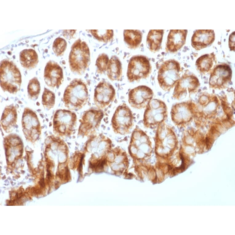 Immunohistochemistry - Anti-beta Catenin Antibody [CTNNB1/1509] (A248300) - Antibodies.com