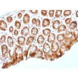 Immunohistochemistry - Anti-beta Catenin Antibody [CTNNB1/1509] (A248300) - Antibodies.com