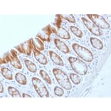 Immunohistochemistry - Anti-beta Catenin Antibody [CTNNB1/1509] (A248300) - Antibodies.com