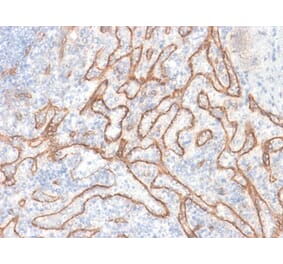 Immunohistochemistry - Anti-beta Catenin Antibody [CTNNB1/2030R] (A248301) - Antibodies.com