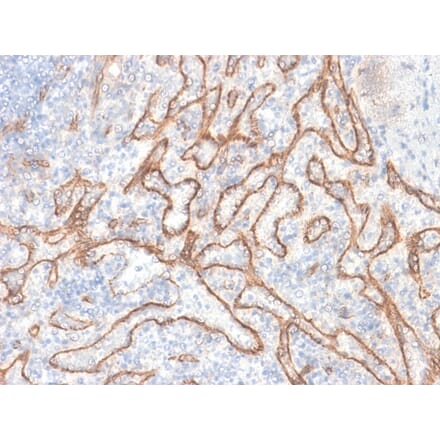 Immunohistochemistry - Anti-beta Catenin Antibody [CTNNB1/2030R] (A248301) - Antibodies.com