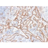 Immunohistochemistry - Anti-beta Catenin Antibody [CTNNB1/2030R] (A248301) - Antibodies.com