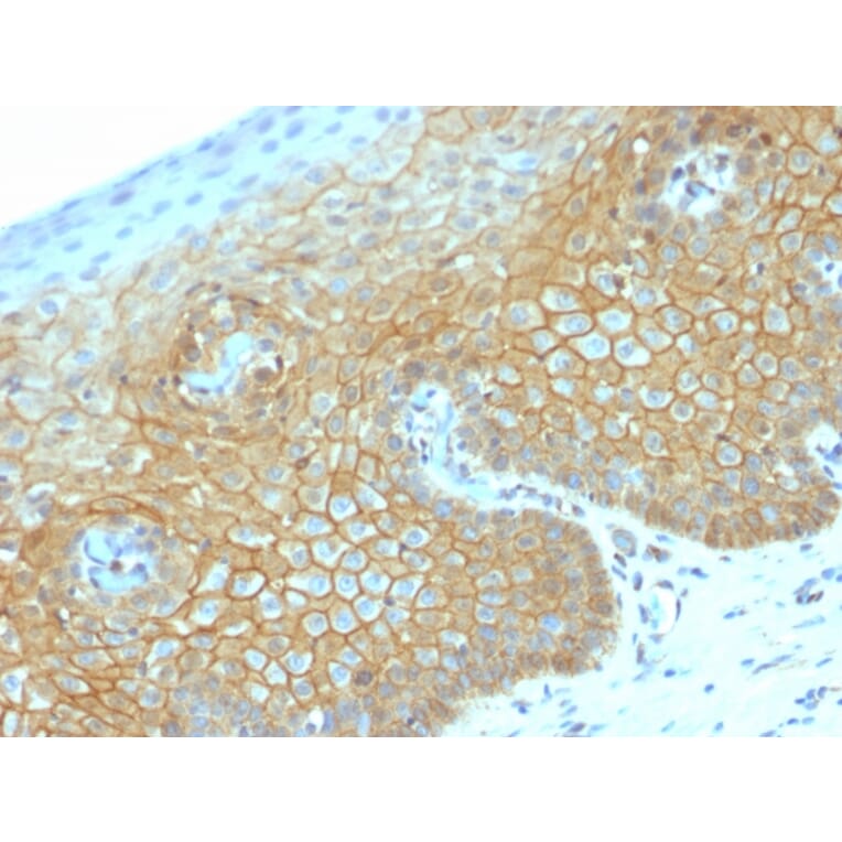 Immunohistochemistry - Anti-beta Catenin Antibody [CTNNB1/2030R] (A248301) - Antibodies.com