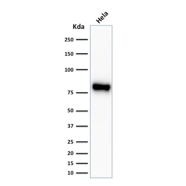 Western Blot - Anti-beta Catenin Antibody [CTNNB1/2030R] (A248301) - Antibodies.com