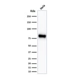 Western Blot - Anti-beta Catenin Antibody [CTNNB1/2030R] (A248301) - Antibodies.com