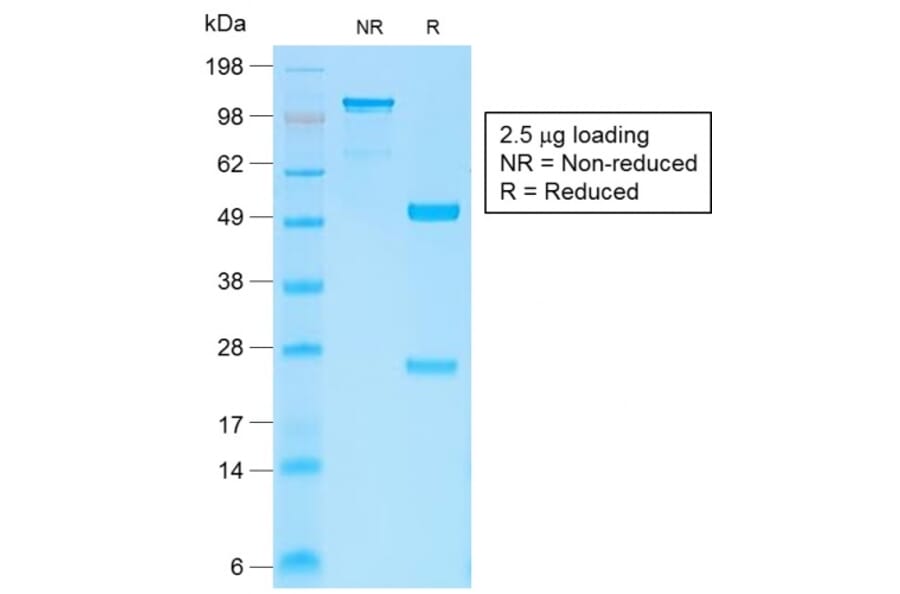 SDS-PAGE - Anti-beta Catenin Antibody [CTNNB1/2030R] (A248301) - Antibodies.com