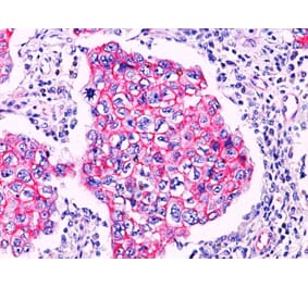 Immunohistochemistry - Anti-beta Catenin Antibody (A248302) - Antibodies.com