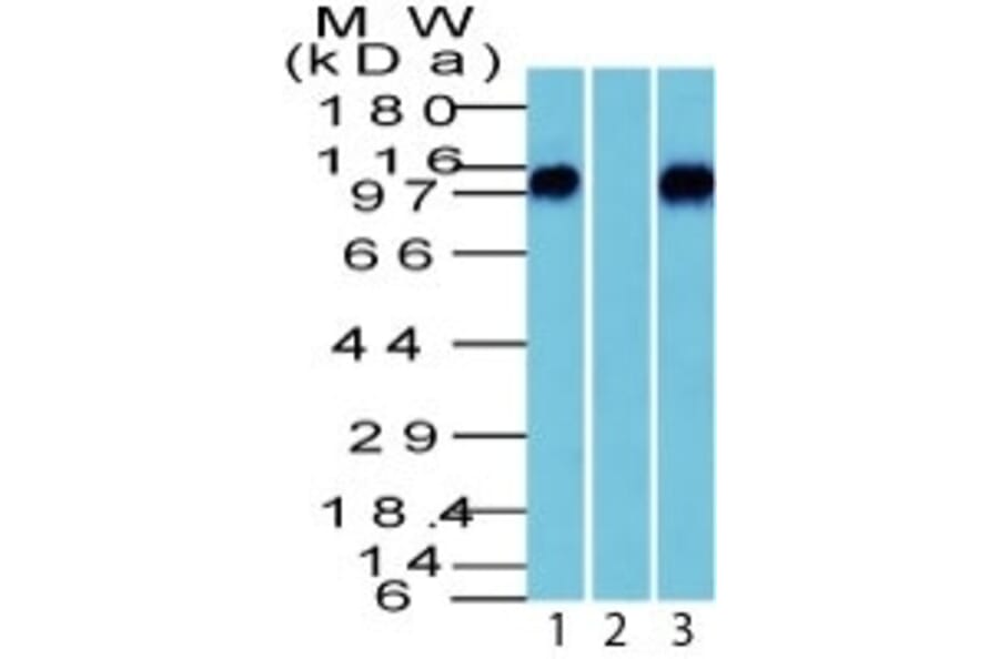 Western Blot - Anti-beta Catenin Antibody (A248302) - Antibodies.com