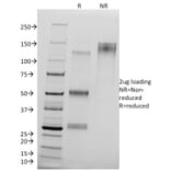 SDS-PAGE - Anti-delta 1 Catenin Antibody [25a] (A248302) - Antibodies.com