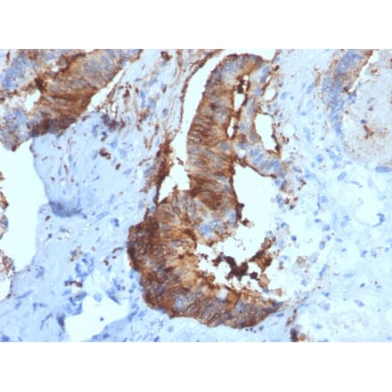 Immunohistochemistry - Anti-Cathepsin D Antibody [CTSD/2781] (A248304) - Antibodies.com