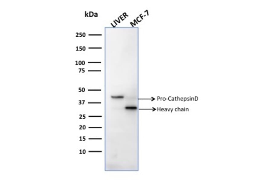 Western Blot - Anti-Cathepsin D Antibody [CTSD/2781] (A248304) - Antibodies.com
