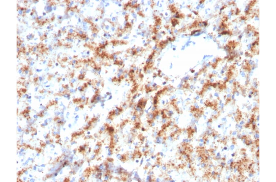 Immunohistochemistry - Anti-Cathepsin D Antibody [CTSD/3082] (A248305) - Antibodies.com
