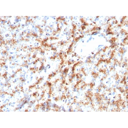 Immunohistochemistry - Anti-Cathepsin D Antibody [CTSD/3082] (A248305) - Antibodies.com