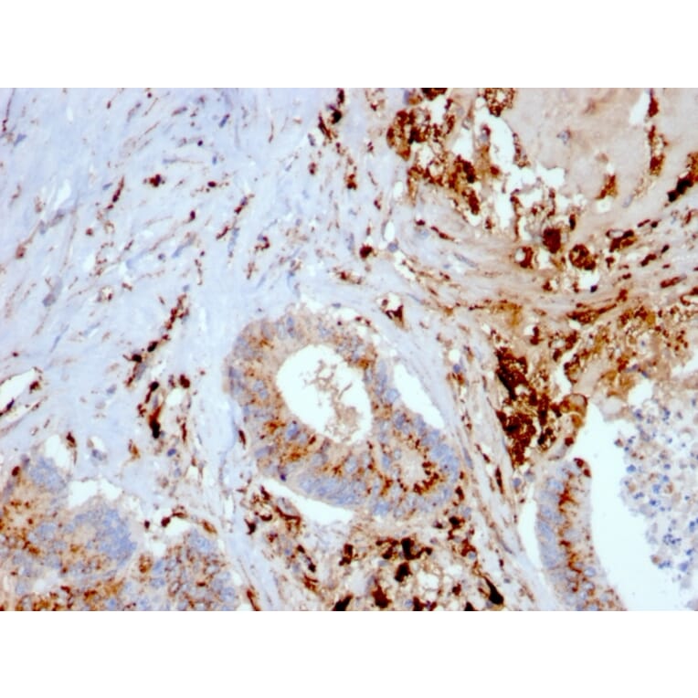 Immunohistochemistry - Anti-Cathepsin D Antibody [CTSD/3082] (A248305) - Antibodies.com