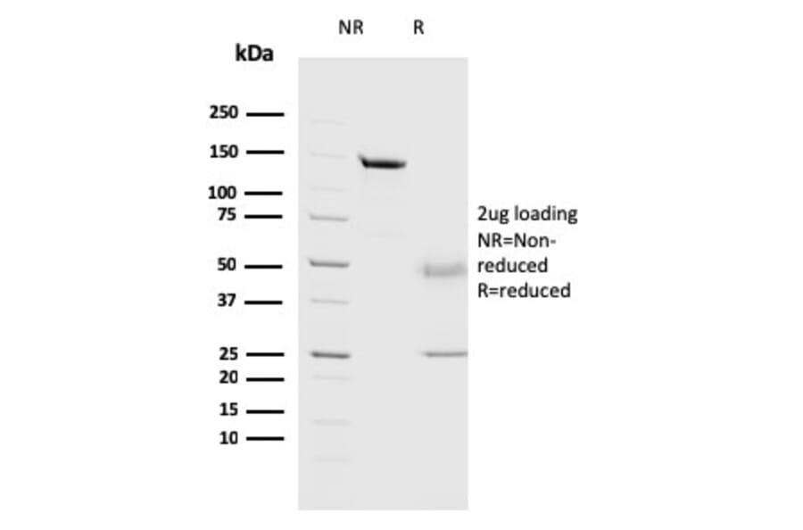 SDS-PAGE - Anti-Cathepsin D Antibody [CTSD/3082] (A248305) - Antibodies.com
