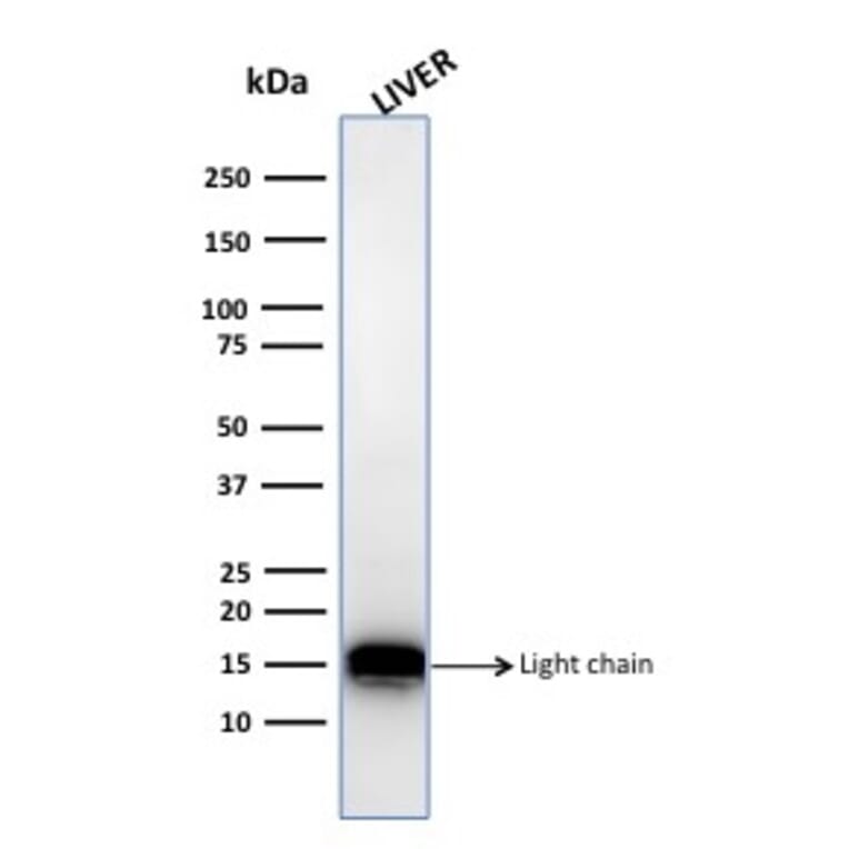 Western Blot - Anti-Cathepsin D Antibody [CTSD/3082] (A248305) - Antibodies.com