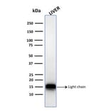 Western Blot - Anti-Cathepsin D Antibody [CTSD/3082] (A248305) - Antibodies.com