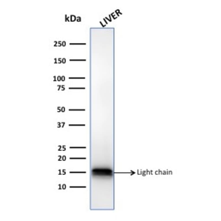 Western Blot - Anti-Cathepsin D Antibody [CTSD/3083] (A248306) - Antibodies.com