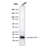 Western Blot - Anti-Cathepsin D Antibody [CTSD/3083] (A248306) - Antibodies.com