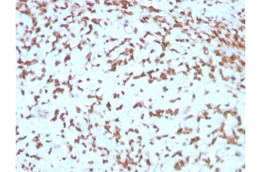 Immunohistochemistry - Anti-Cathepsin D Antibody [CTSD/3275] (A248307) - Antibodies.com
