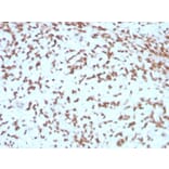 Immunohistochemistry - Anti-Cathepsin D Antibody [CTSD/3275] (A248307) - Antibodies.com