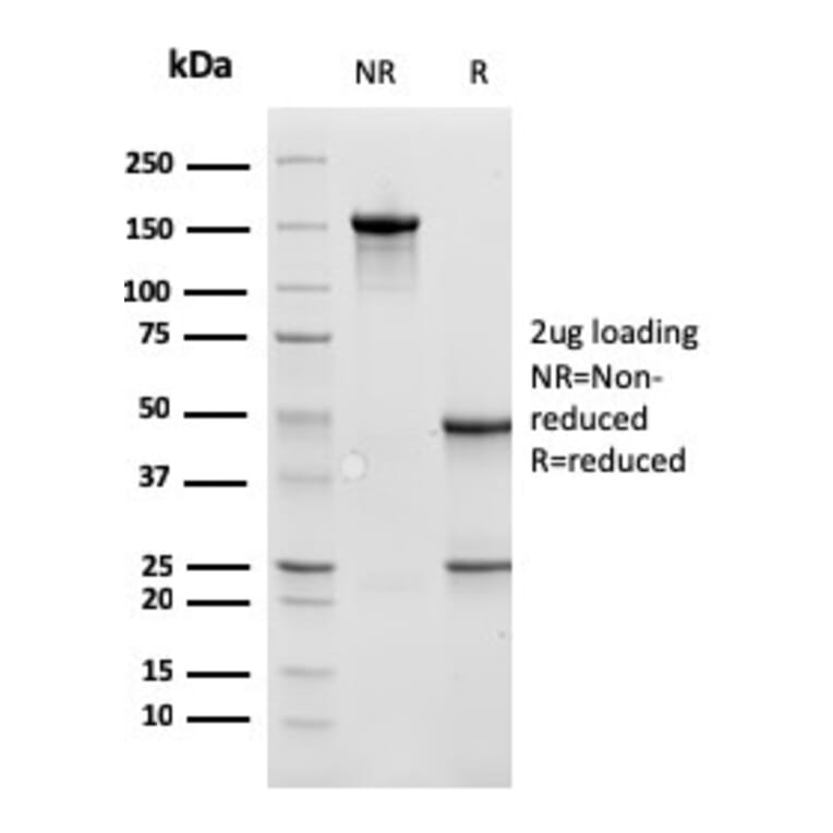 SDS-PAGE - Anti-Cathepsin D Antibody [CTSD/3275] (A248307) - Antibodies.com