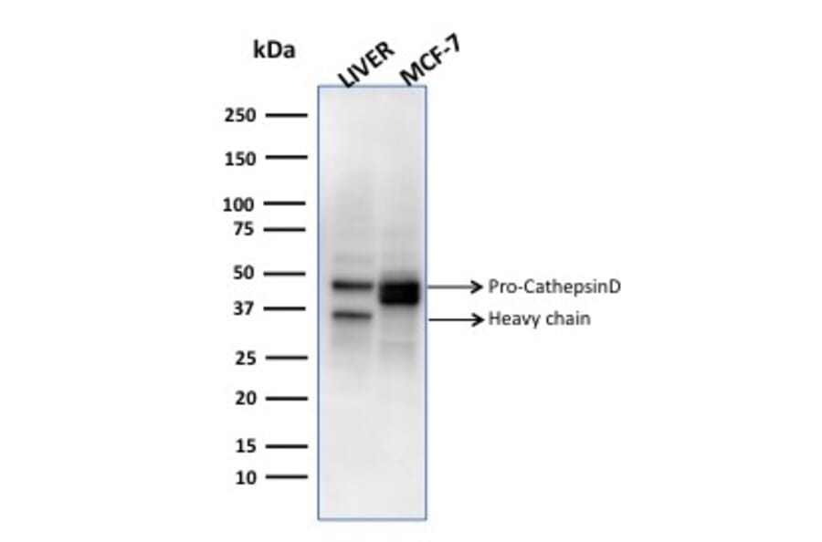 Western Blot - Anti-Cathepsin D Antibody [CTSD/3275] (A248307) - Antibodies.com