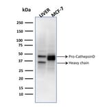 Western Blot - Anti-Cathepsin D Antibody [CTSD/3275] (A248307) - Antibodies.com