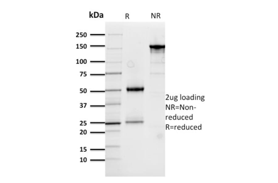 SDS-PAGE - Anti-Cathepsin D Antibody [CTSD/3276] (A248308) - Antibodies.com