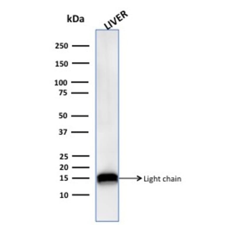 Western Blot - Anti-Cathepsin D Antibody [CTSD/3276] (A248308) - Antibodies.com
