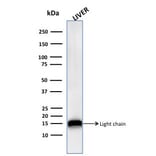Western Blot - Anti-Cathepsin D Antibody [CTSD/3276] (A248308) - Antibodies.com