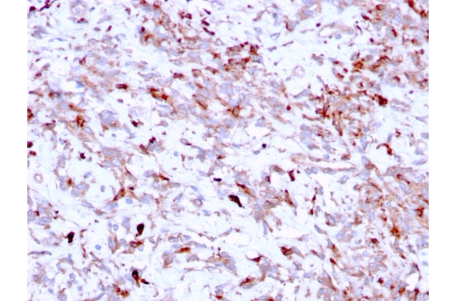 Immunohistochemistry - Anti-Cathepsin K Antibody [CTSK/2791] (A248309) - Antibodies.com