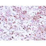 Immunohistochemistry - Anti-Cathepsin K Antibody [CTSK/2791] (A248309) - Antibodies.com