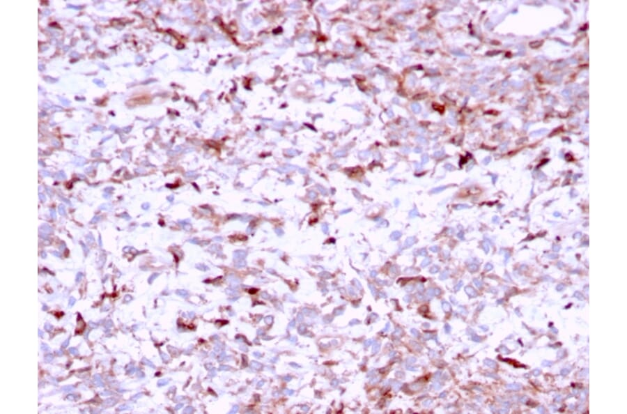 Immunohistochemistry - Anti-Cathepsin K Antibody [CTSK/2791] (A248309) - Antibodies.com
