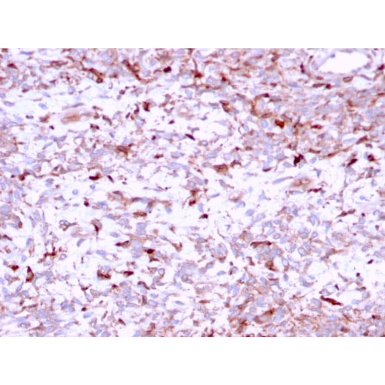 Immunohistochemistry - Anti-Cathepsin K Antibody [CTSK/2791] (A248309) - Antibodies.com