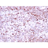 Immunohistochemistry - Anti-Cathepsin K Antibody [CTSK/2791] (A248309) - Antibodies.com