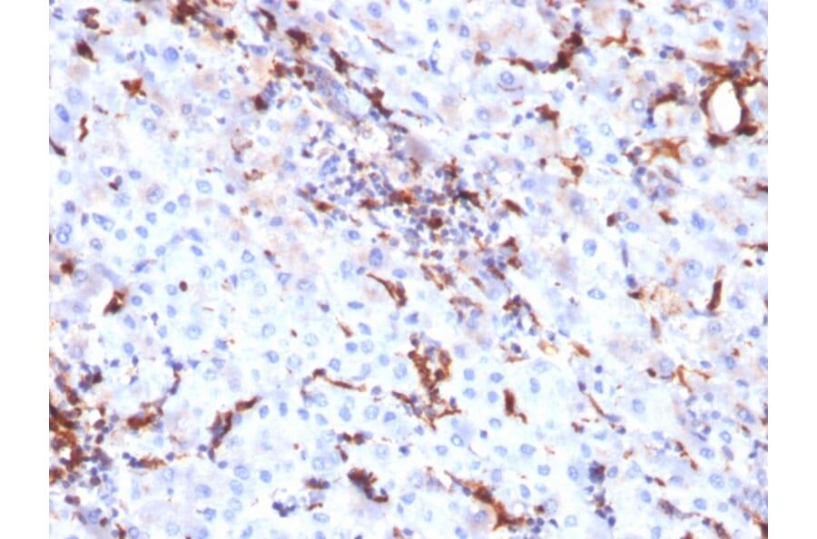 Immunohistochemistry - Anti-Cathepsin K Antibody [CTSK/2791] (A248309) - Antibodies.com