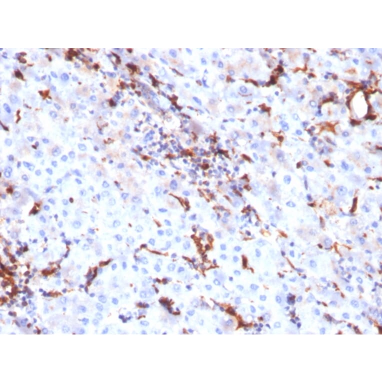 Immunohistochemistry - Anti-Cathepsin K Antibody [CTSK/2791] (A248309) - Antibodies.com