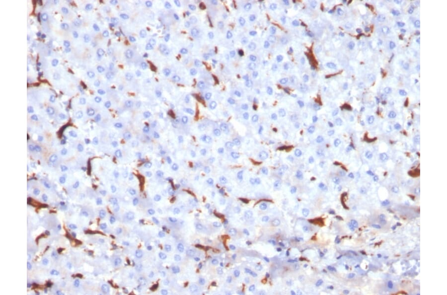 Immunohistochemistry - Anti-Cathepsin K Antibody [CTSK/2791] (A248309) - Antibodies.com