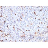 Immunohistochemistry - Anti-Cathepsin K Antibody [CTSK/2791] (A248309) - Antibodies.com