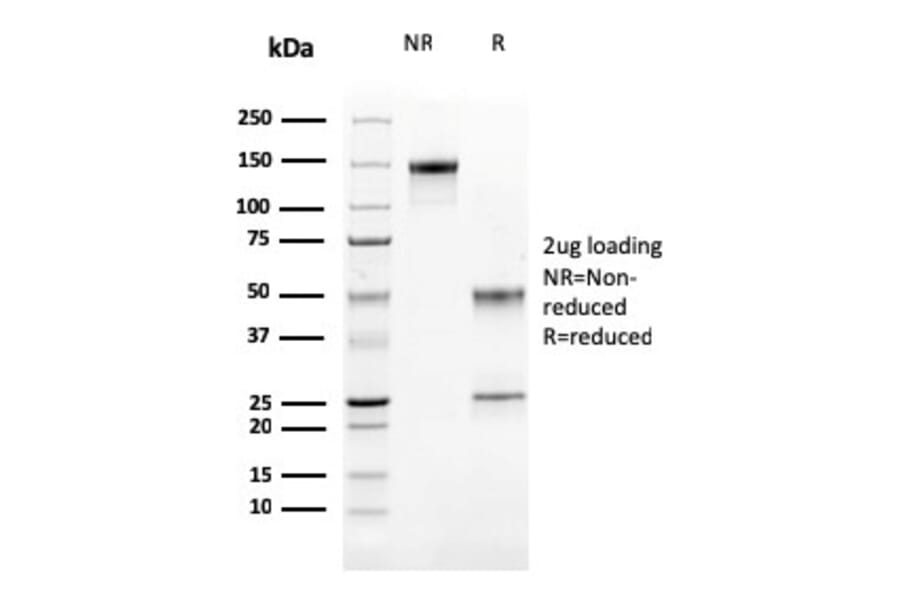 SDS-PAGE - Anti-Cathepsin K Antibody [CTSK/2791] (A248309) - Antibodies.com