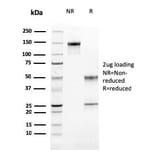 SDS-PAGE - Anti-Cathepsin K Antibody [CTSK/2791] (A248309) - Antibodies.com